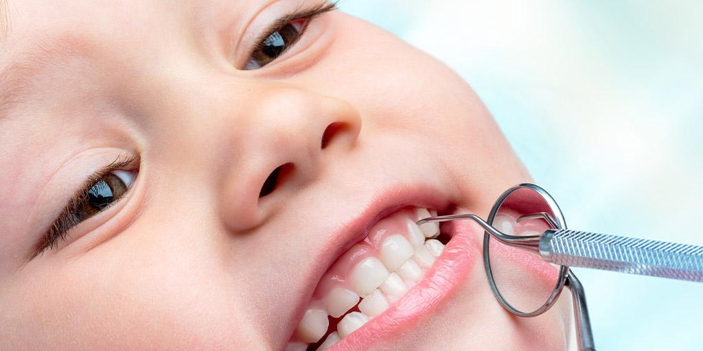 Shielding Little Smiles: The Power of Dental Sealants